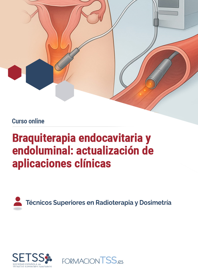 Braquiterapia endocavitaria y endoluminal: actualización de aplicaciones clínicas
